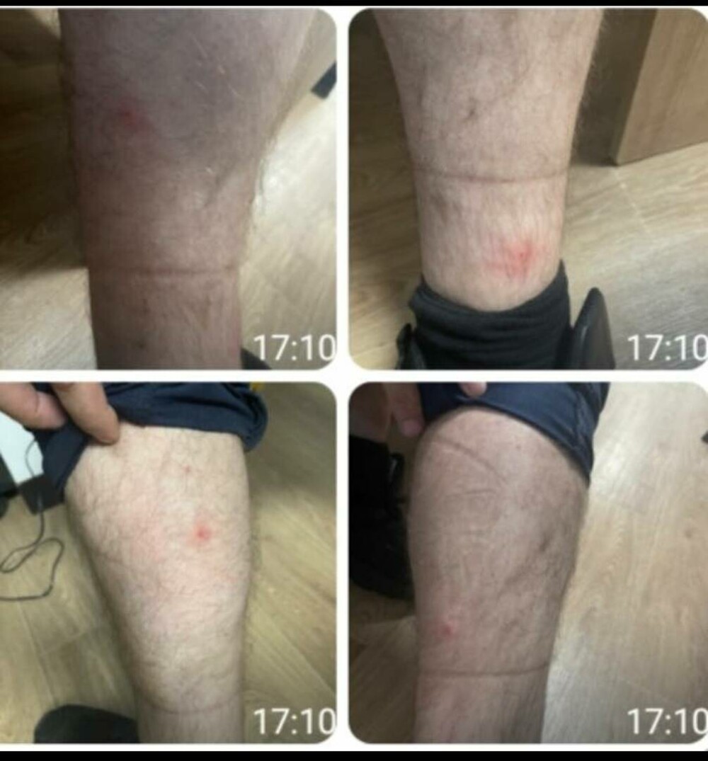 Sediile Poliției Capitalei sunt invadate de ploșnițe. Peste 10 agenți au ajuns la UPU din cauza mușcăturilor - Imaginea 3