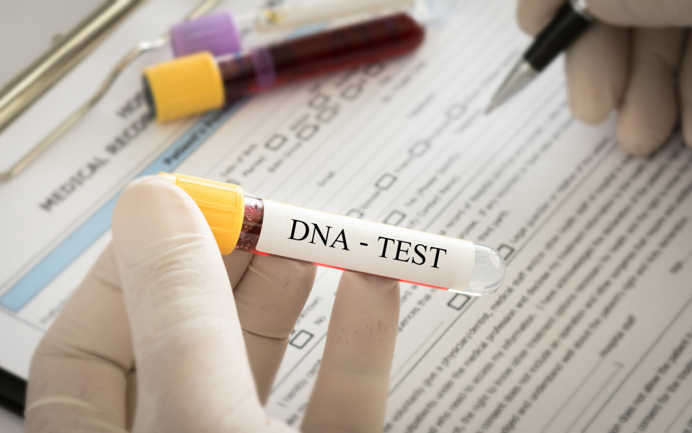 ADN test