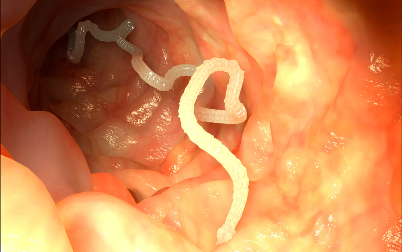 Limbricii – paraziti intestinali