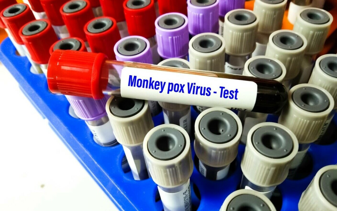 variola maimutei