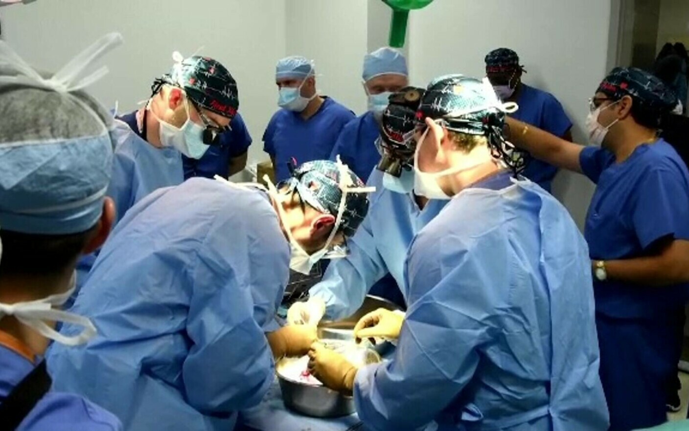 operatie, chirurg