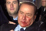 Silvio Berlusconi, plin de sange, dupa un atac incredibil