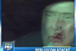 Silvio Berlusconi, plin de sange! Are nasul spart si doi dinti rupti!