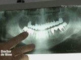 Cum afectează fumatul sănătatea dentară: Dinți pierduți pe nesimțite