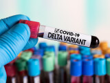 Studiu CDC: Varianta Delta nu produce cazuri grave în rândul copiilor