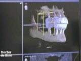 Dinții perfecți, creați digital: inteligența artificială și imprimarea 3D transformă estetica dentară