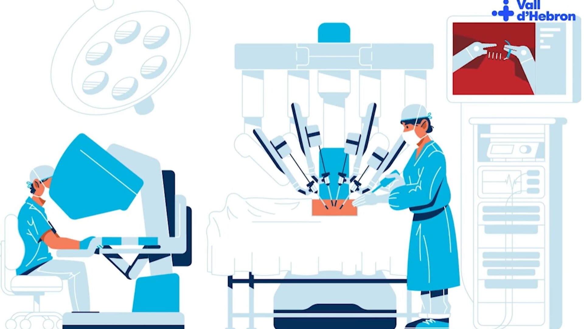 Transplant pulmonar Spania