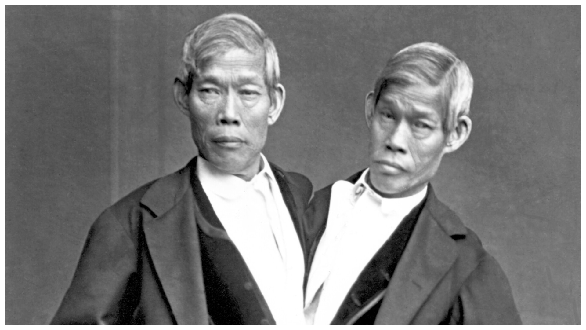 Chang and Eng Bunker