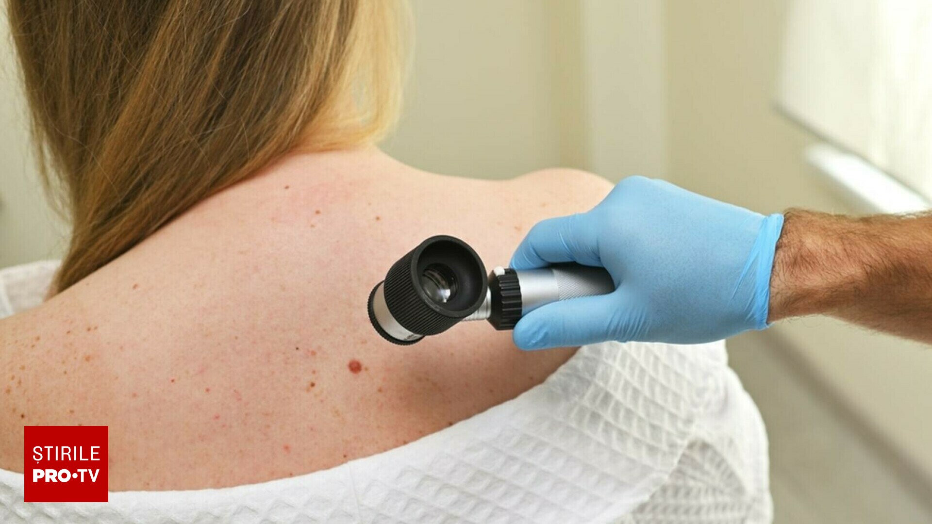 Mulți români fac cancer de piele pentru că ”așa au auzit ei”, să nu meargă la doctor. Boala incipientă este 100% vindecabilă