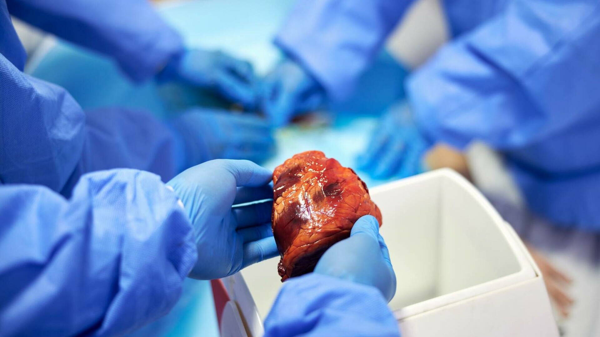 transplant organe