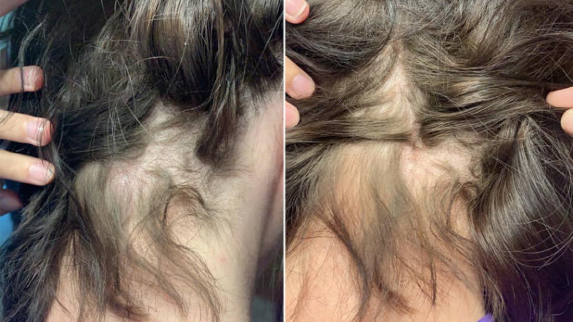 O femeie din Wisconsin a rămas cheală după ce și-a cumpărat un balsam de păr