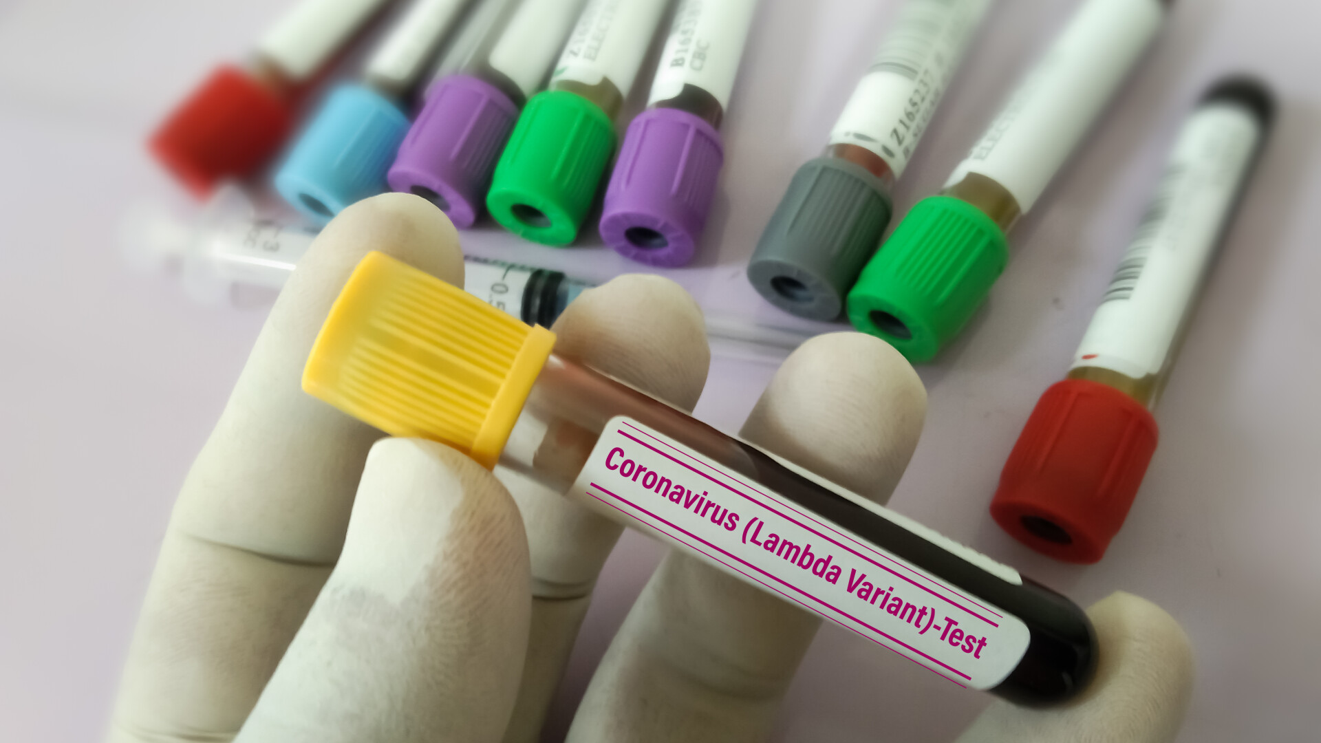 Coronavirus România, bilanț 31 august. Ultimele raportări cu privire la evoluția infectărilor