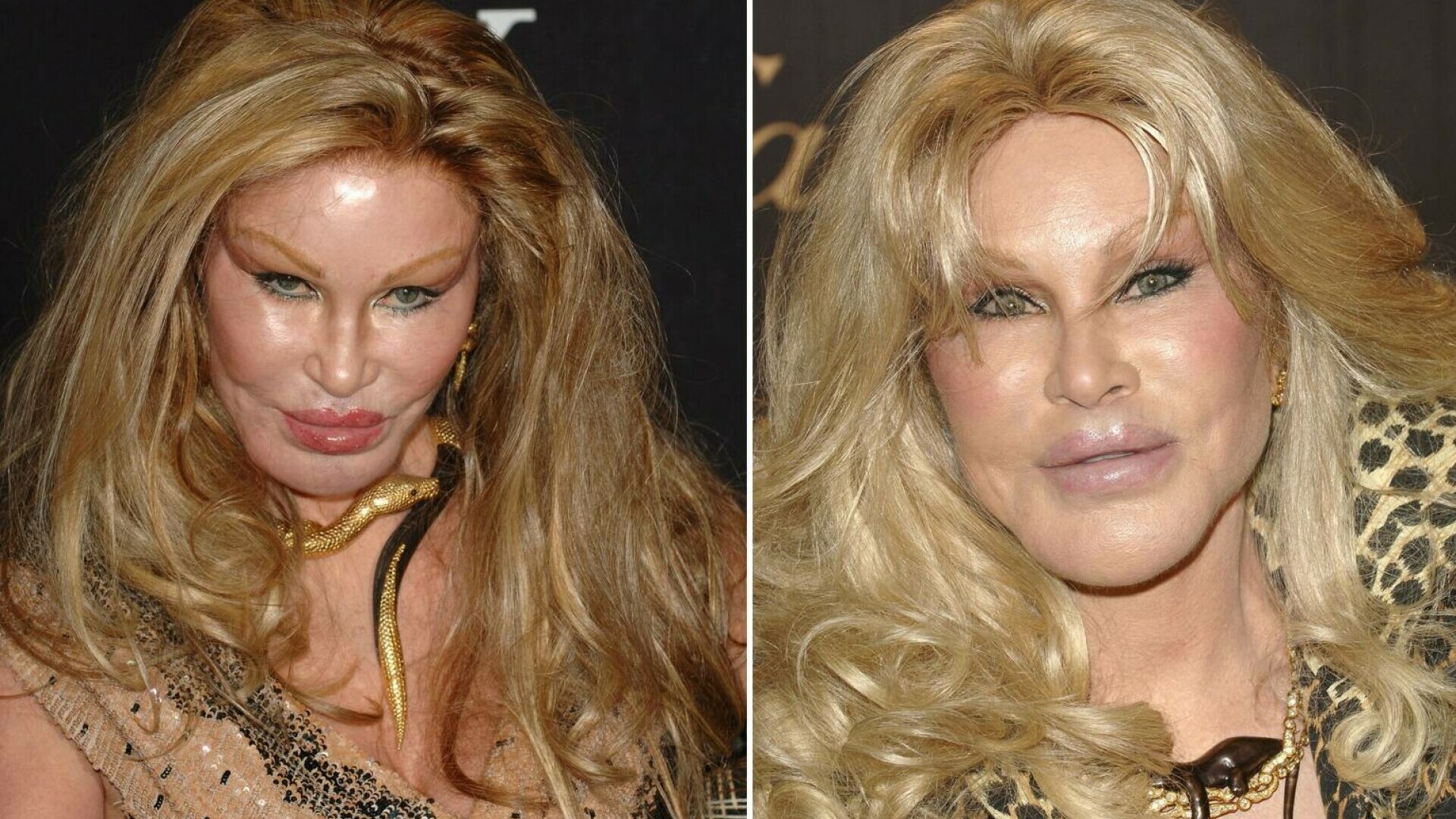 Jocelyn Wildenstein