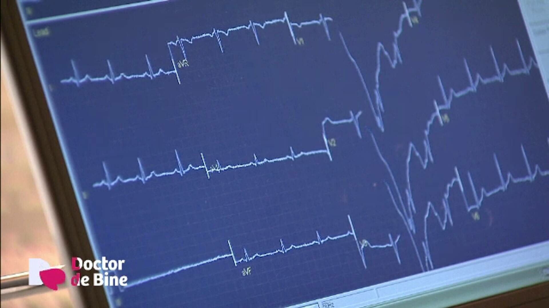 Mișcarea este echilibrul chimicalelor dintre creier, inimă și vase. Legătura cu impulsurile electrice