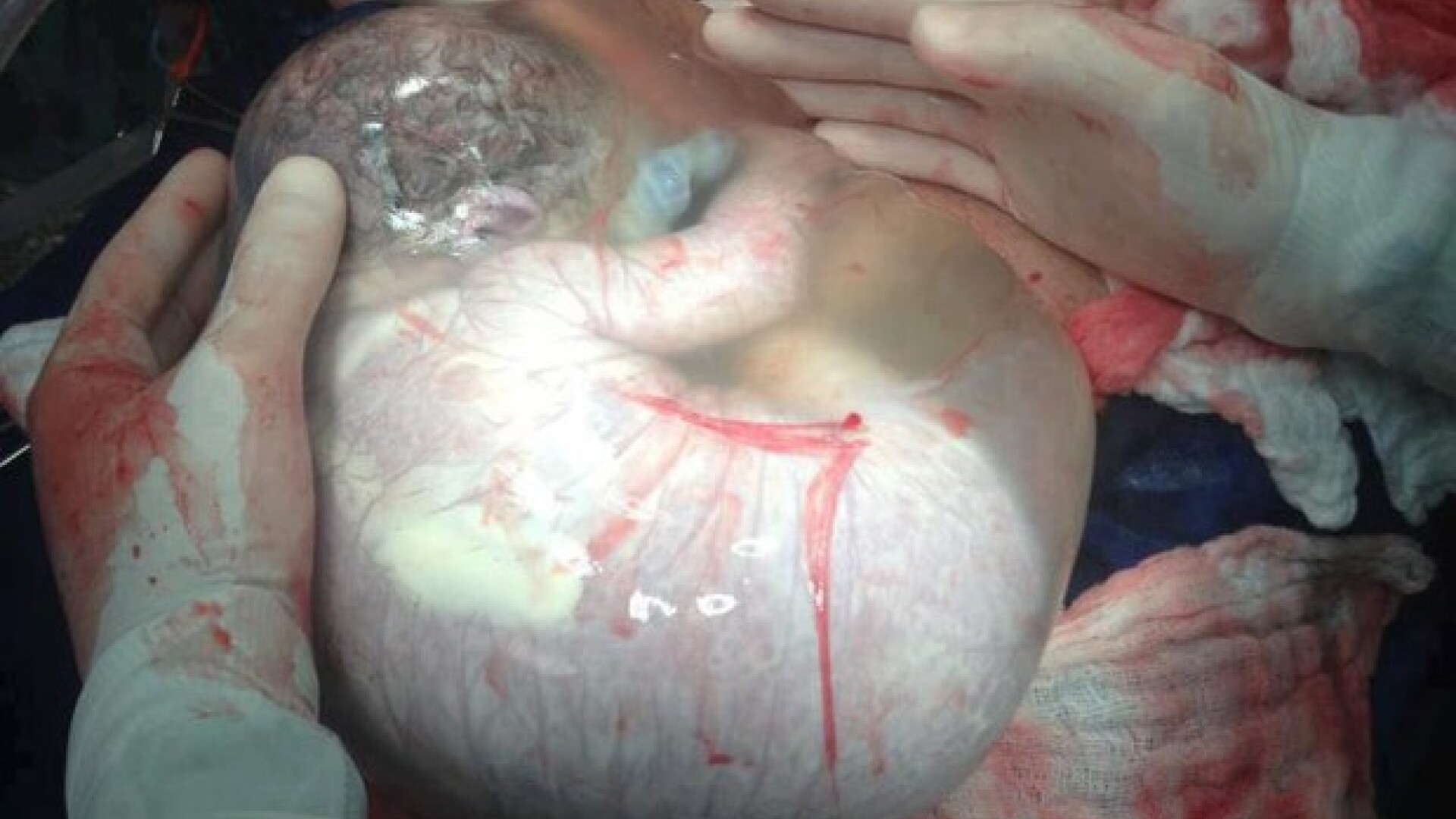 bebelus in sac amniotic