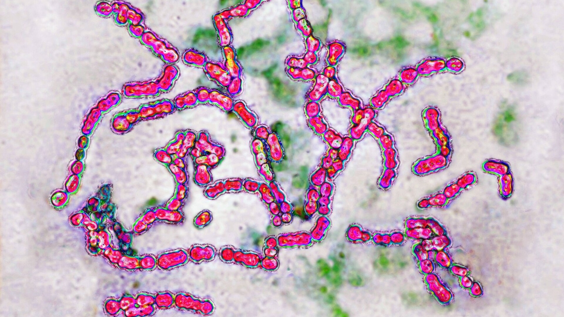 bacterie mâncătoare de carne