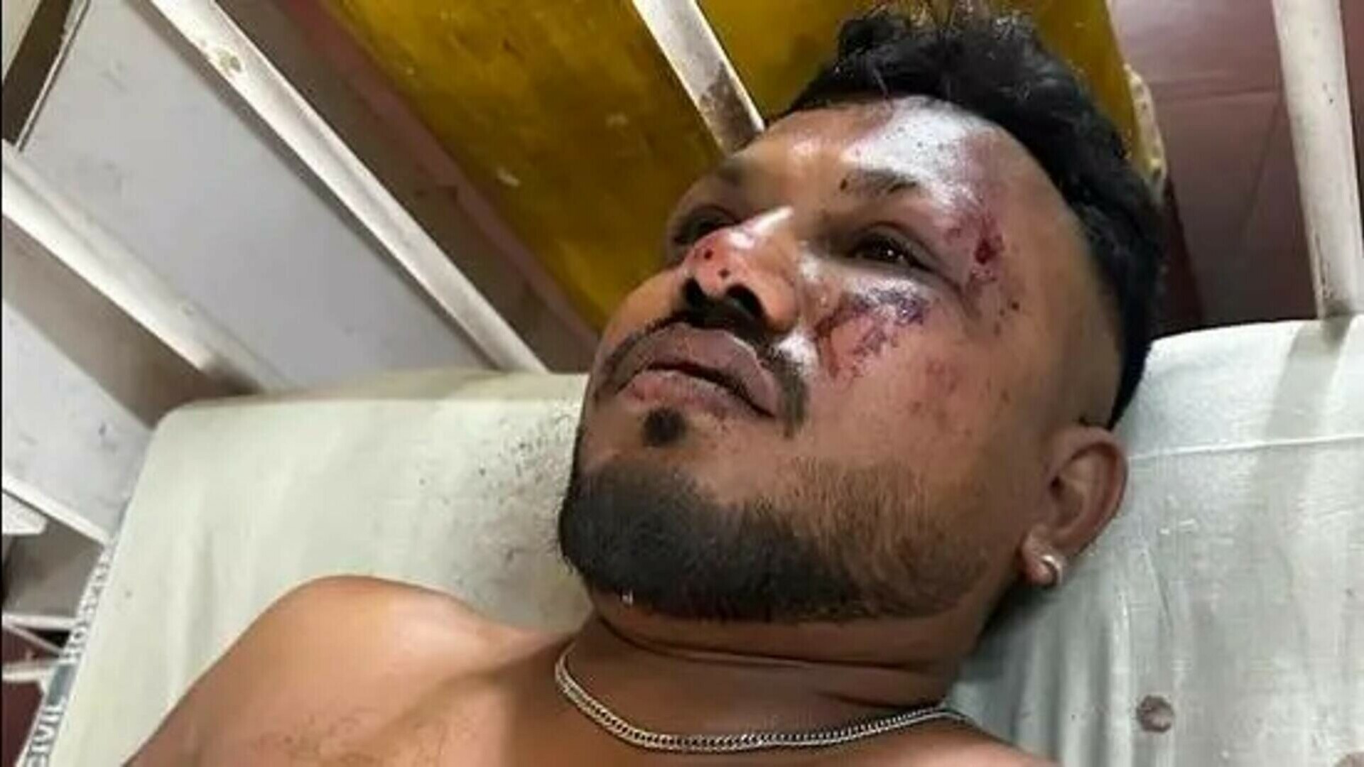 Un singur pasager a supraviețuit miraculos catastrofei aviatice din India. „Erau cadavre în jurul meu”