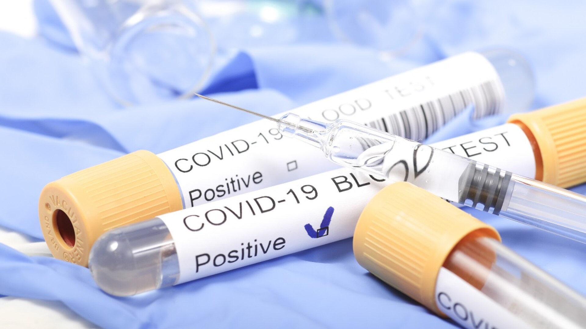 mostra unei probe de testare pentru identificarea noului virus gripal COVID-19 (coronavirus).