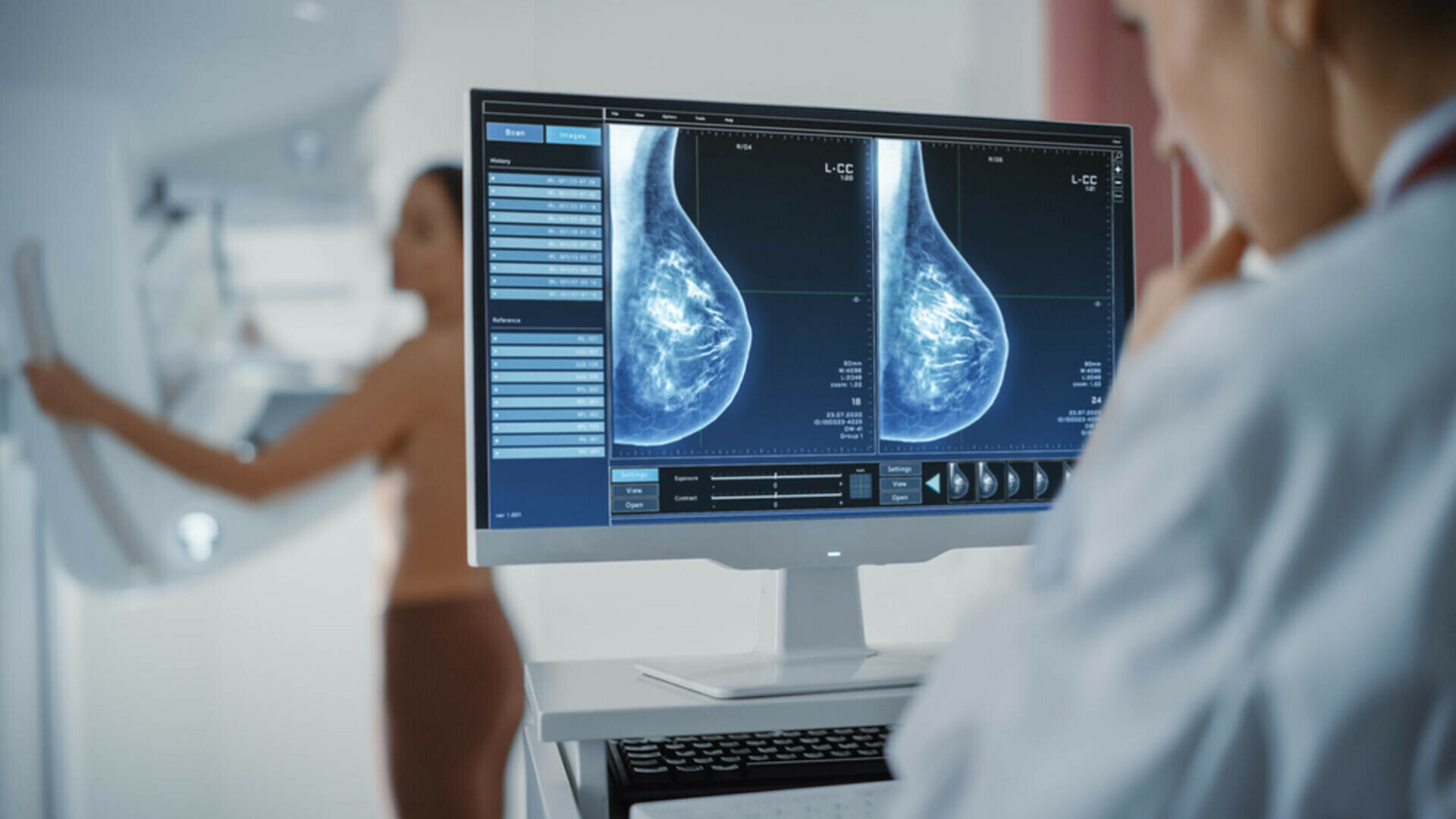 Un nou medicament ar reduce simptomelor femeilor care fac tratament pentru cancerul de sân. Ce arată un studiu