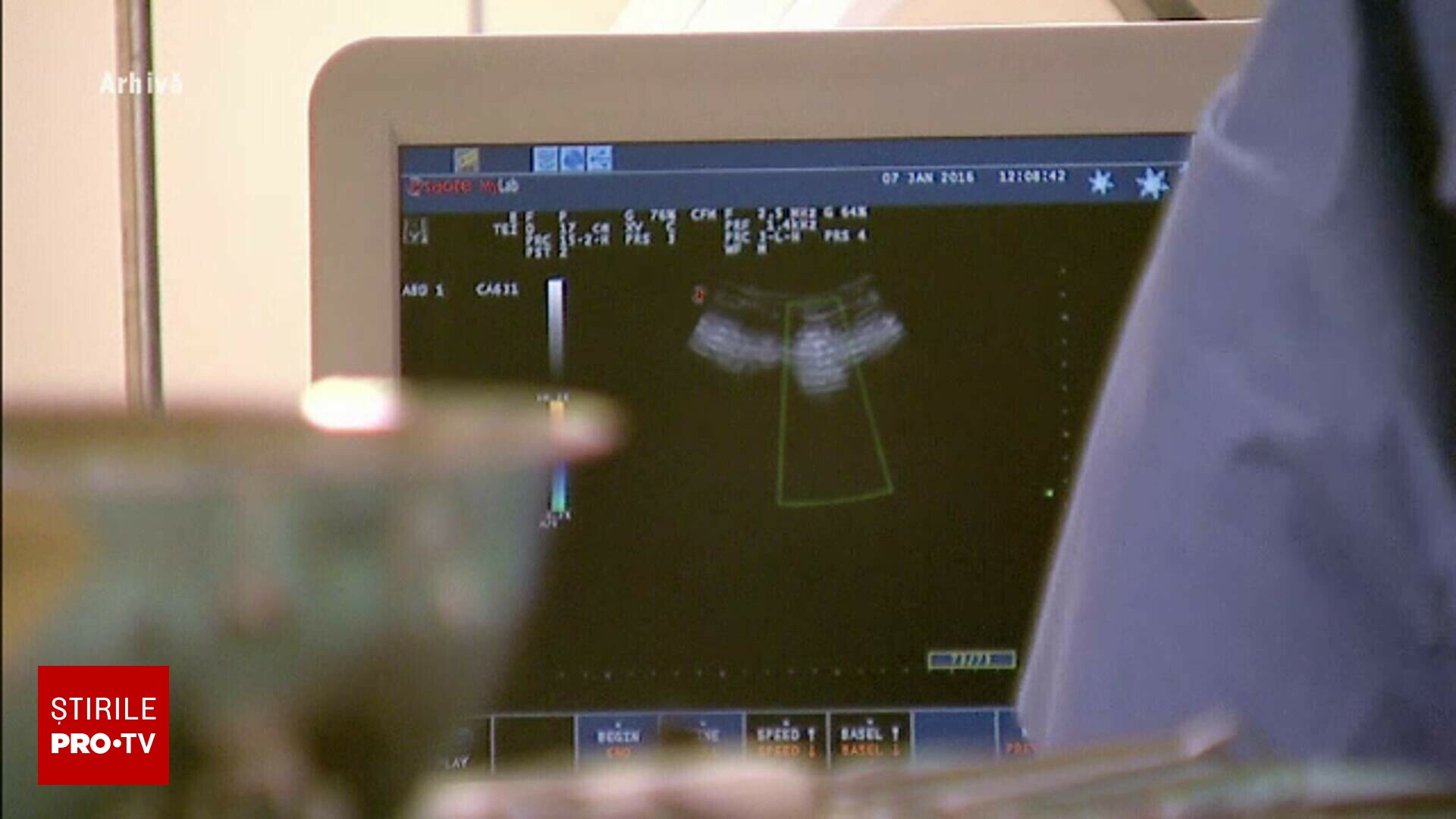 Un adolescent din Iași a intrat în moarte cerebrală după ce a fost bătut îngrozitor. Familia a acceptat donarea organelor