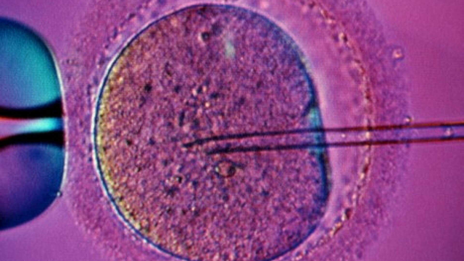 fertilizare in vitro