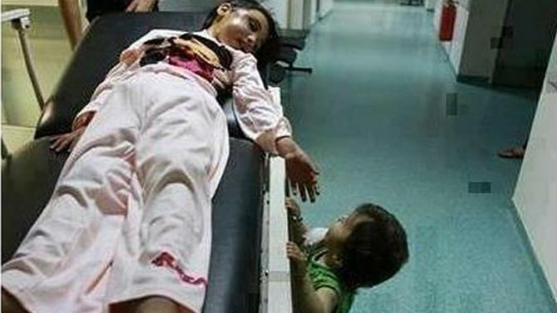 poza, copii raniti, Siria