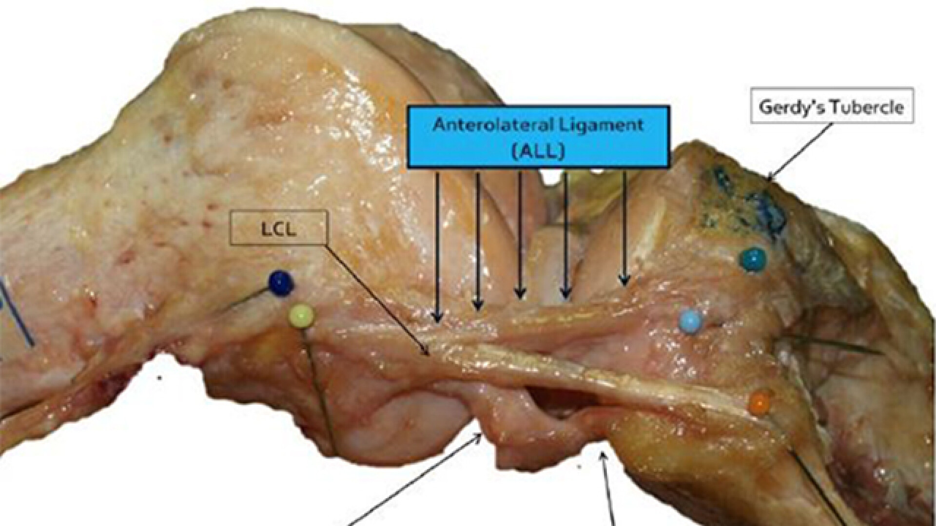 ligament