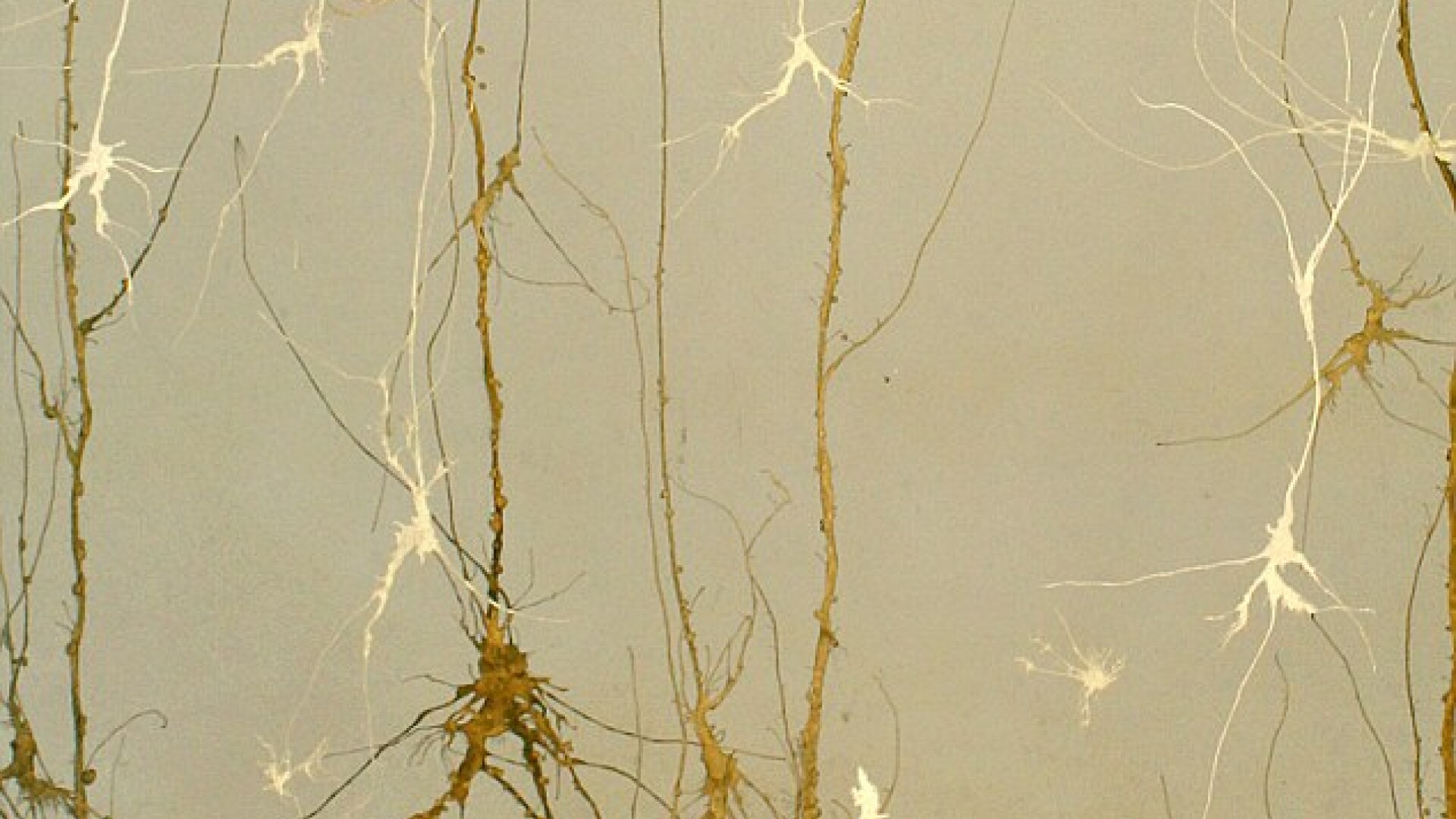 neuroni