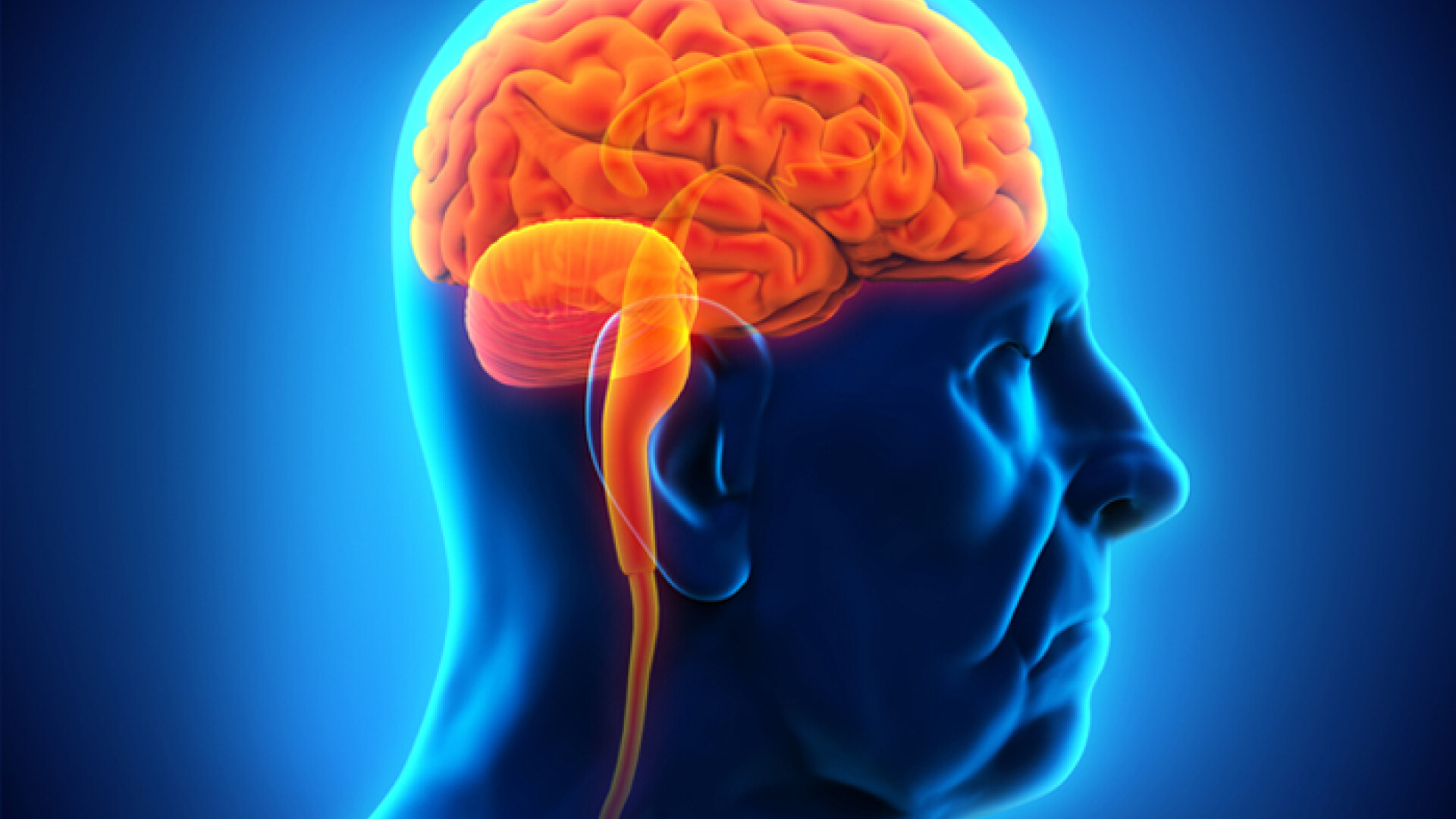 grafica creier afectat de Alzheimer