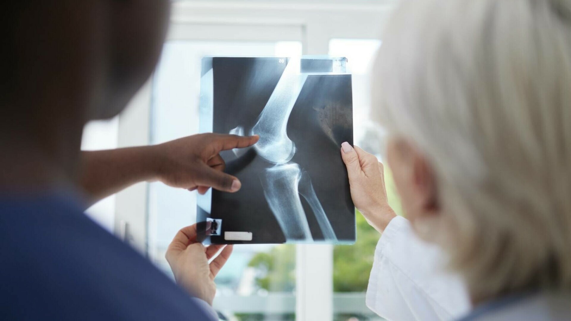 O femeie din Coreea de Sud cu dureri la genunchi a descoperit la radiografie că avea articulațiile pline de fire de aur