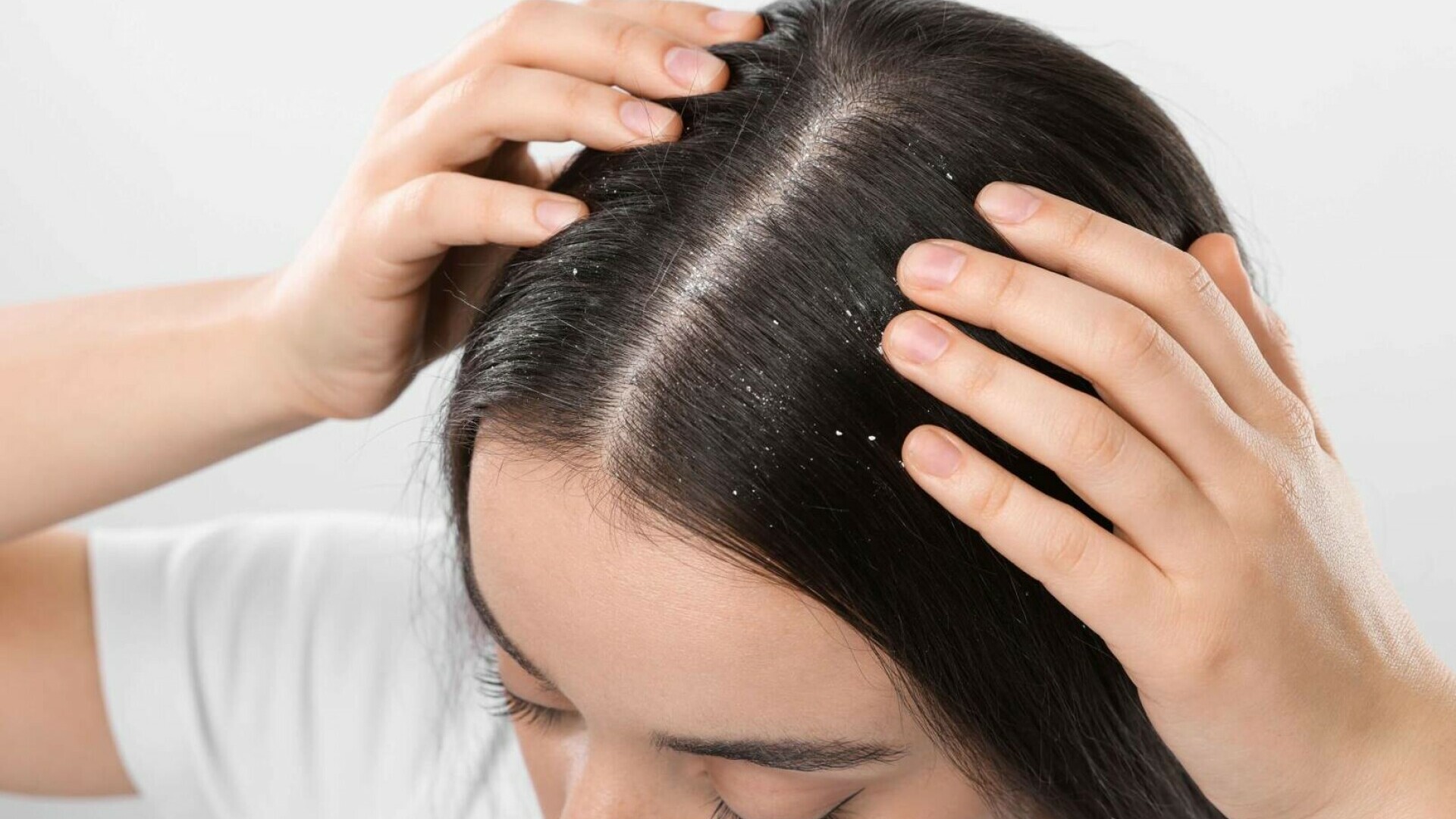 sampon antimatreata promo