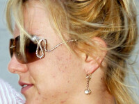 Fata urata a celebritatilor! O GALERIE FOTO cu adevarat infricosatoare!