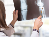 radiografie Shutterstock