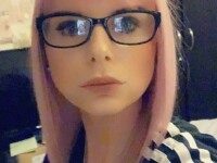 Femeie desfigurată în urma unei proceduri de înfrumusețare: 