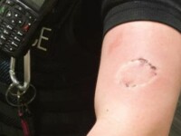 Polițistă mușcată de braț în Marea Britanie. Agresorul, supărat pentru măsurile de izolare