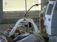 pacient ventilat mecanic