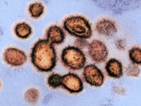 Cum arată coronavirusul care produce COVID-19. Imagini în premieră de la cercetători - 13