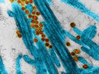 Imaginea unei celule infectate cu Covid-19 publicată de Institutul Național francez de Sănătate
