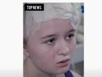 O fată din Ucraina a supraviețuit miraculos după ce o bucată de șrapnel i s-a înfipt în cap și s-a oprit în creier