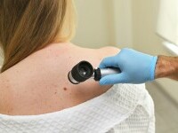 Studiu: Un medicament folosit împotriva paraziţilor intestinali ar putea fi tratament pentru cancer de piele agresiv