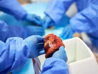 transplant organe
