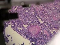 piele la microscop