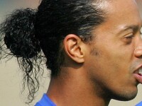 Ronaldinho a fost supus unei operatii de remodelare a gingiilor si dintilor