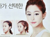 Operatia estetica din Coreea de Sud care le face pe tinere sa 