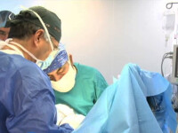 operatie, medici