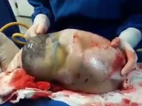 bebelus in sac amniotic