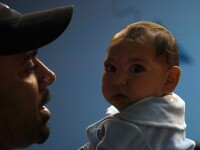 copil suferind de microcefalie de Zika