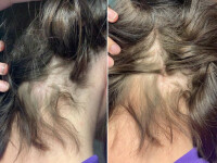 O femeie din Wisconsin a rămas cheală după ce și-a cumpărat un balsam de păr