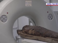Premieră în România: o mumie de peste 2.000 de ani a fost scanată cu un computer tomograf. Ce vor să afle cercetătorii