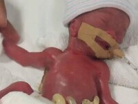 Cum arată la externare bebelușul care cântărea 212 grame când s-a născut